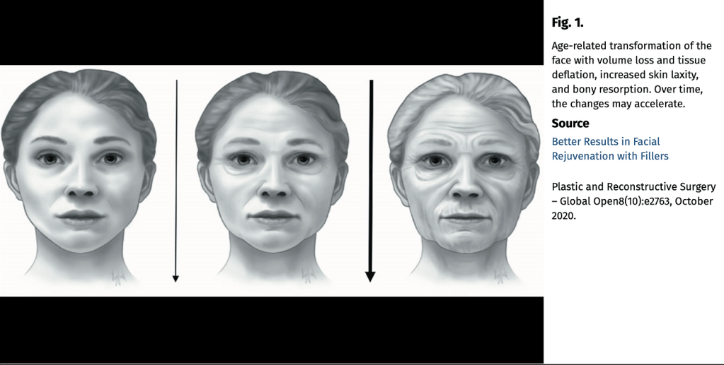 Understanding Facial Fillers: Volume Loss and&nbsp;Aging